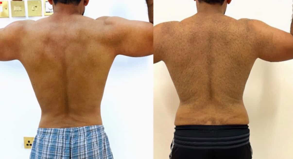 BJ Fitness — client transformation progress (2)